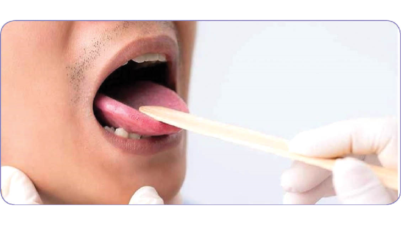 نشانه‌ها و علائم سرطان زبان ؛ از بوی بد دهان تا زخم و درد