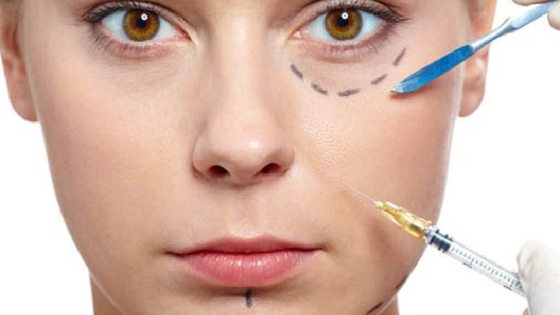 فیلرها و بایوفیلر چیست و چه فرقی با هم دارند