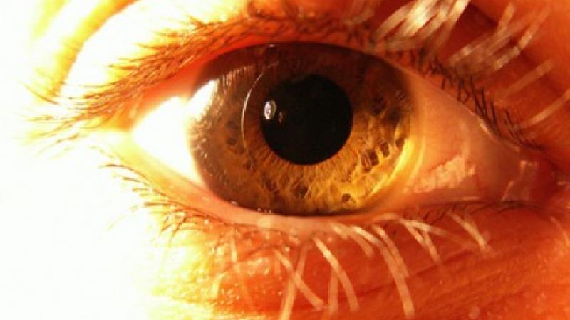 مرد بی رحم چشمان زنش را کور کرد