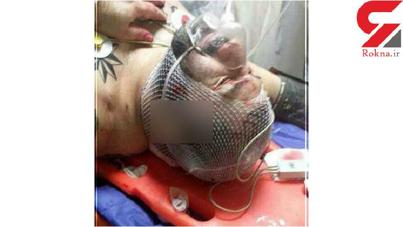 حمله دو موتور سوار به هانی کرده