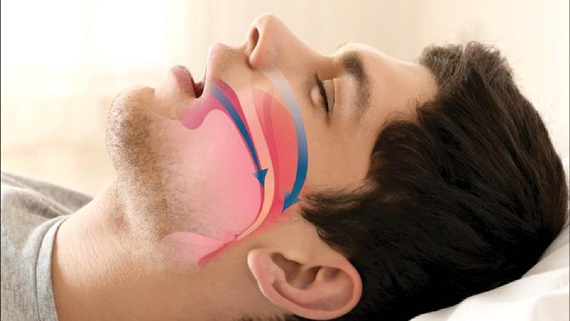 دلایل خر و پف و راه درمان آن چیست