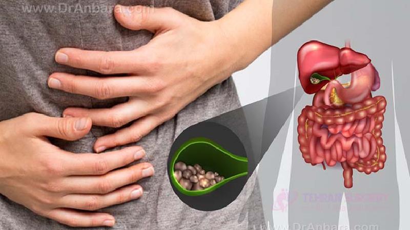 سنگ کیسه صفرا چرا ایجاد می‌شود و راه‌های درمان آن چیست