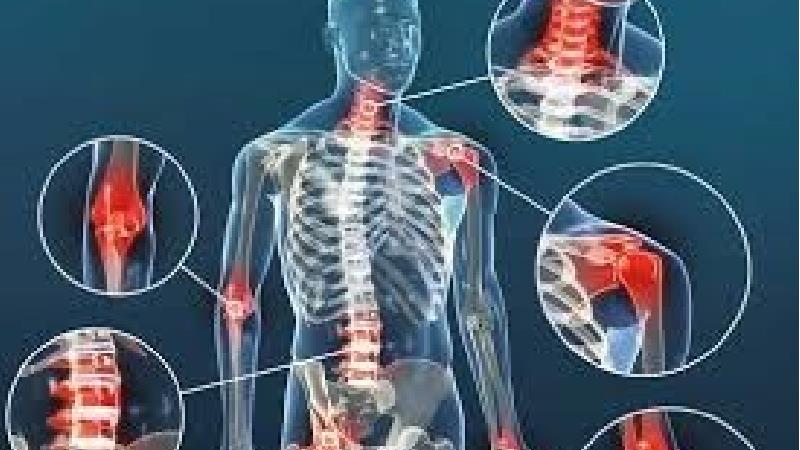 علائمی كه از شروع آرتروز خبر می‌د‌هند‌