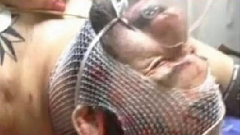 هانی کرده همچنان در کما است