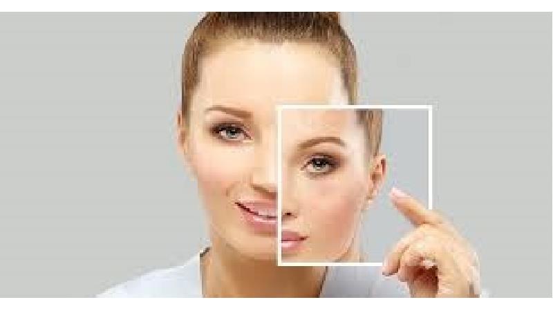 هایفوتراپی صورت چیست + مزایا و عوارض و نظرات مردم