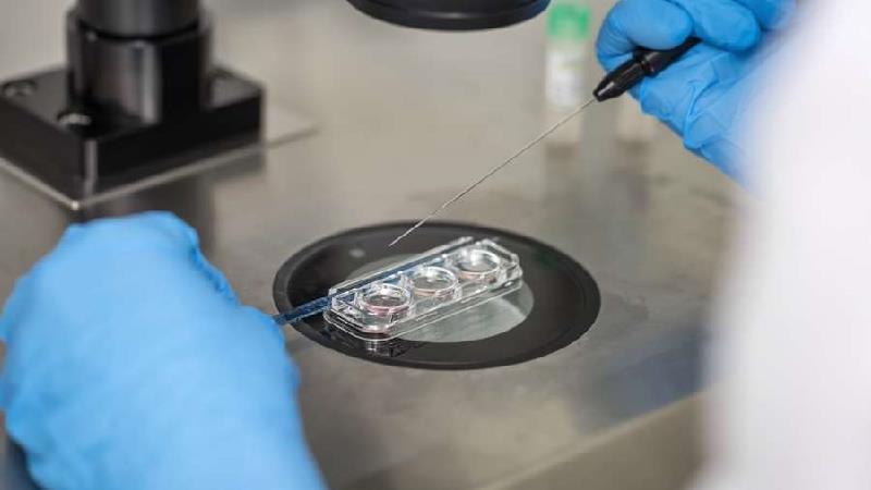 IVF یا لقاح مصنوعی چیست و برای چه کسانی و چگونه انجام می‌شود