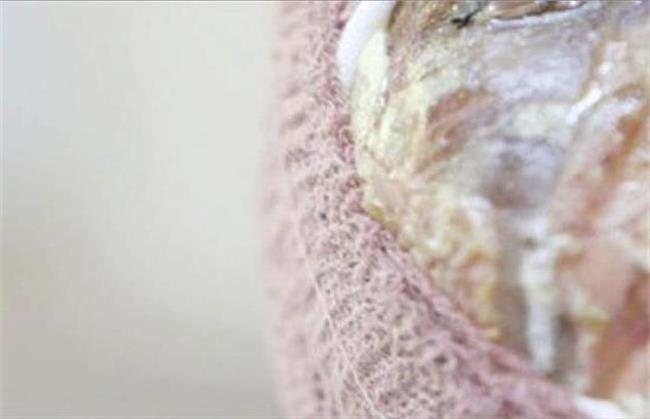 زن اسیدپاش شوهر صیغه‌ای را کور کرد