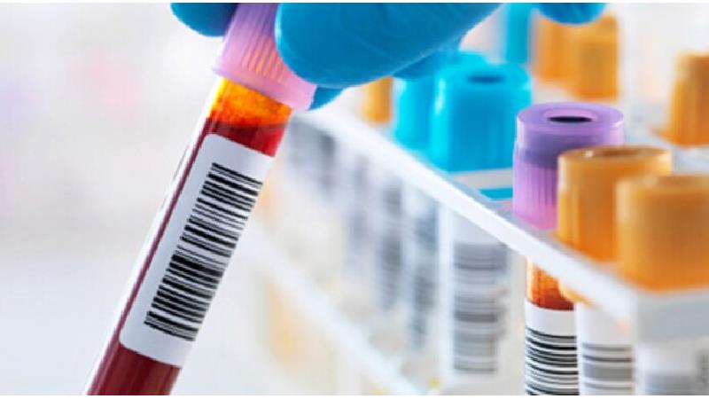 آیا گروه خونی به ابتلا به کرونا مربوط است؟