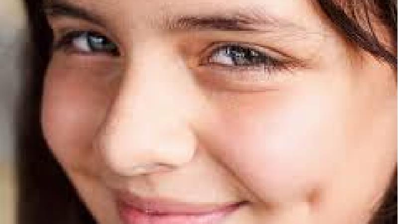 چگونه  بدون جراحی چال گونه ایجاد کنیم