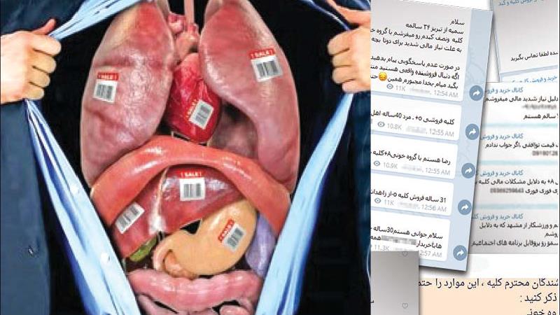 گزارشی تکاندهنده از بازار فروش کبد و کلیه