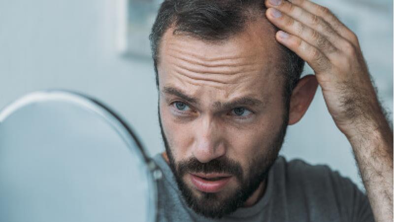 درمان و جلوگیری از ریزش مو با این خوراکی‌ها