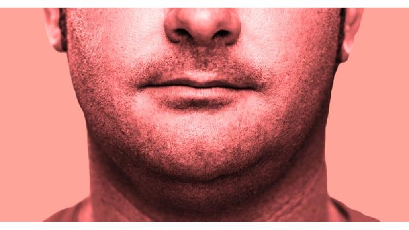 چگونه از شر چربی‌های صورت خلاص شویم