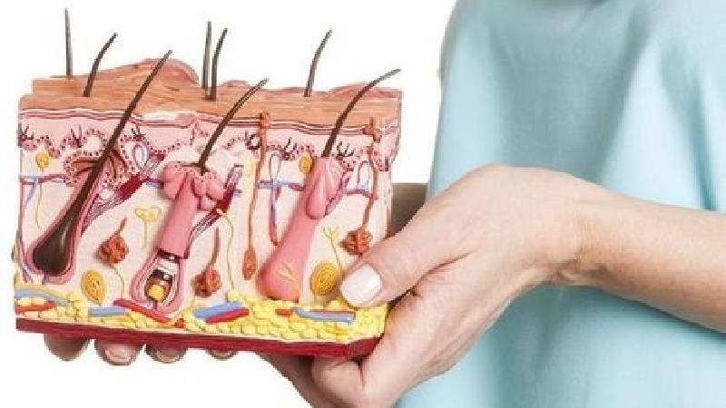 علایم و راه‌های درمان کیست مویی چیست