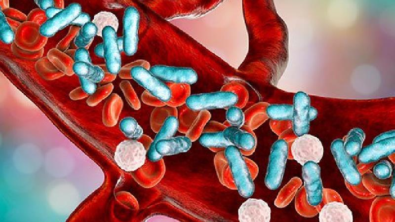 سپسیس چیست و چرا به وجود می‌آید + علایم و راه درمان