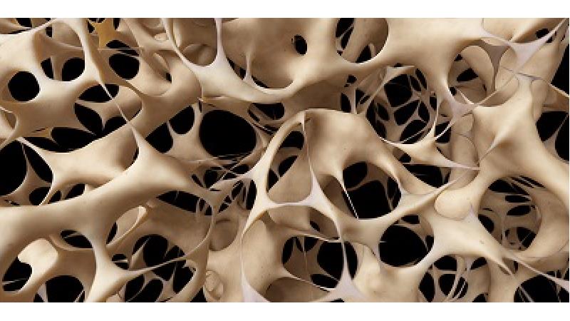 چه کار کنیم که دچار پوکی استخوان نشویم