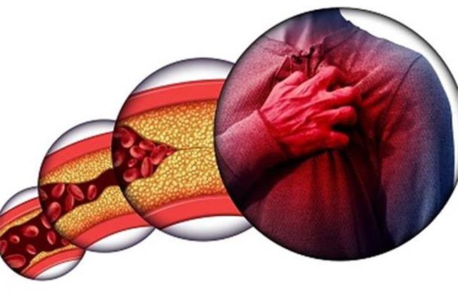 بهترین روش‌ها برای کاهش کلسترول خون بدون دارو