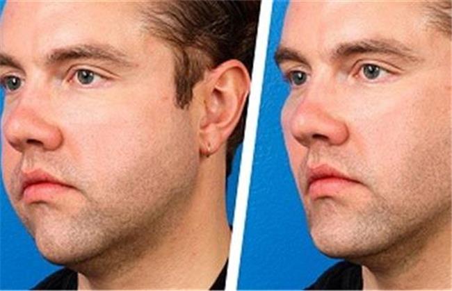 برای لاغری صورت چه کار کنیم