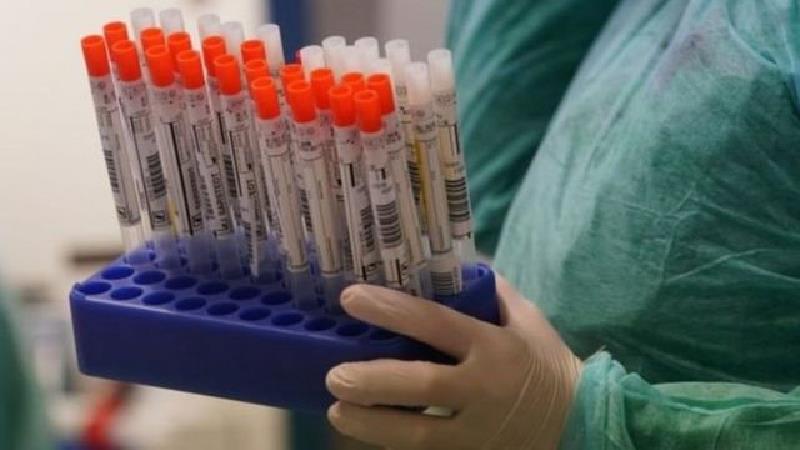 بیمه تست کرونا چه شرایطی دارد