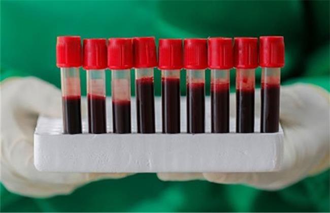 گروه های خونی مختلف چی بخورند؛ تغذیه مناسب