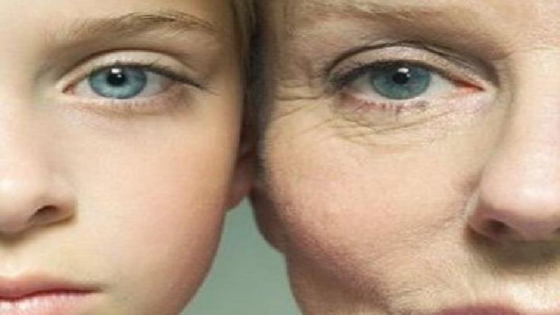 نشانه ها و علائم پیری زودرس چیست + مهم ترین دلایل