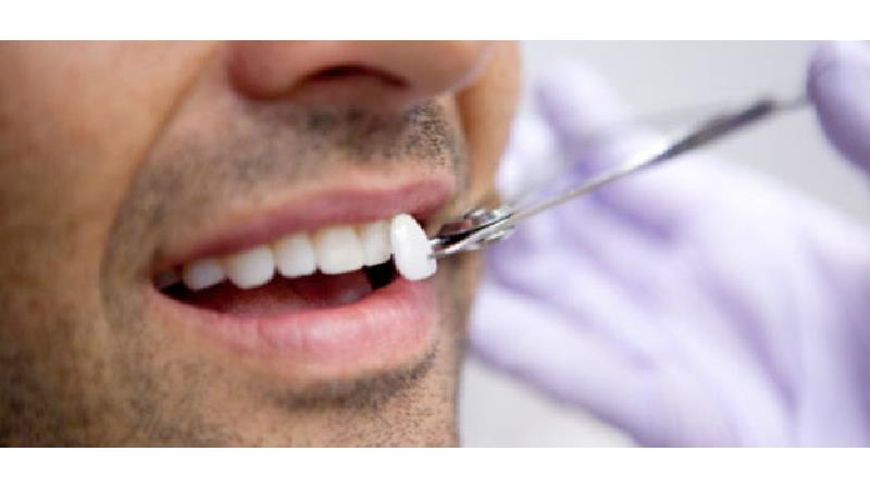 فاصله بین دندان ها چه دلایلی دارد