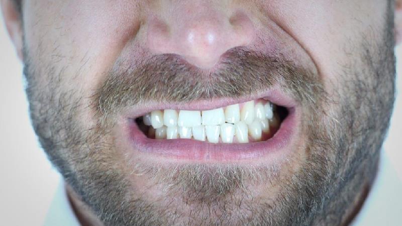 دلایل دندان قروچه در خواب و راه های پیشگیری