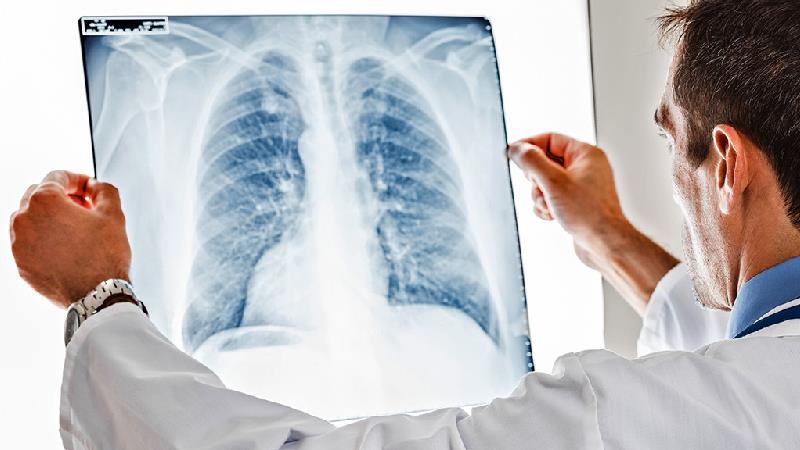 سندروم زجر تنفسی چیست؛ دلایل و راه درمان