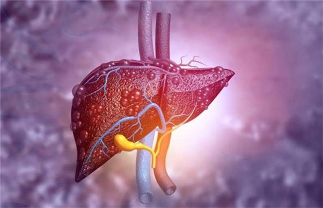 برای کبد چرب چی بخوریم