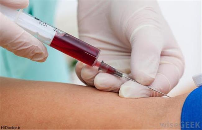 غلظت خون؛ علایم، راه تشخیص و خوراکی های مفید