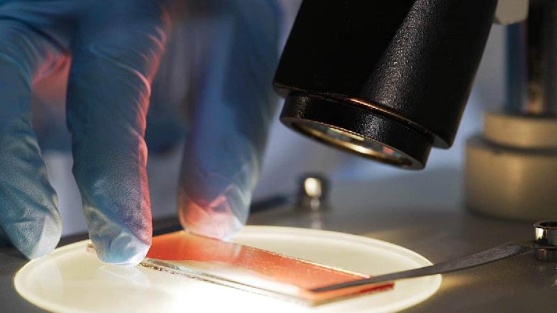 سرطان مغز استخوان؛ علائم، راه درمان و دلایل ابتلا