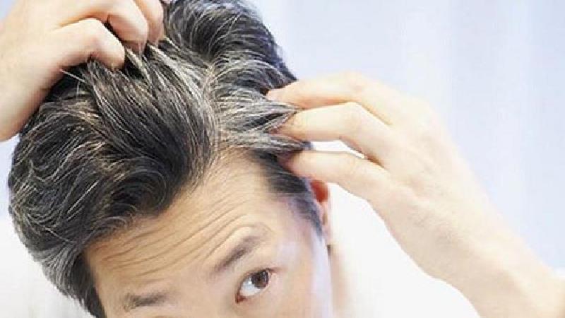 چه کار کنیم موهایمان سفید نشود