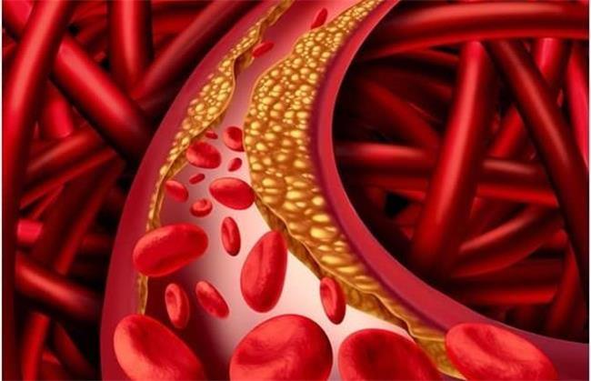 کلسترول خون را چگونه کم کنیم