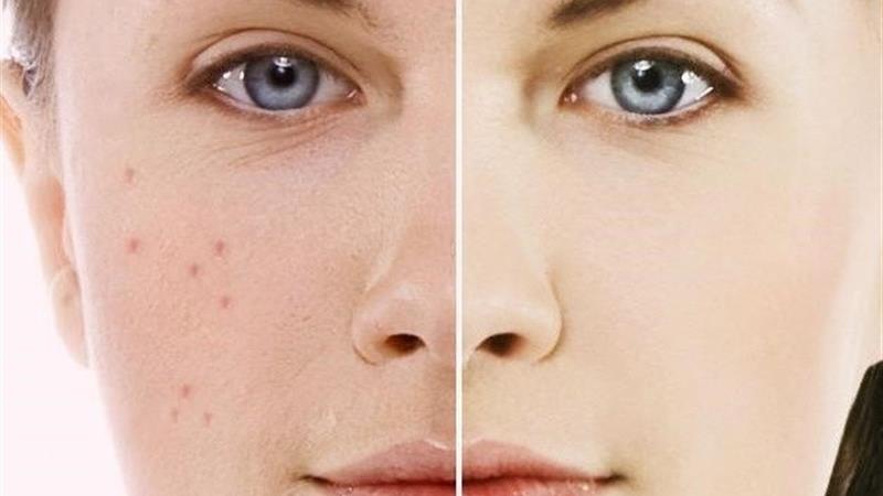 تغذیه مناسب برای داشتن پوست زیبا؛ از گیاهان تا گوشت و ماهی