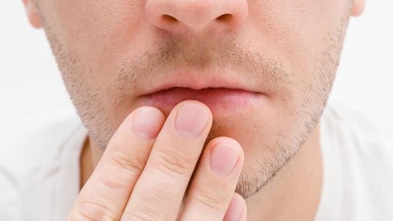 دلایل خشکی دهان و راه های درمان آن چیست