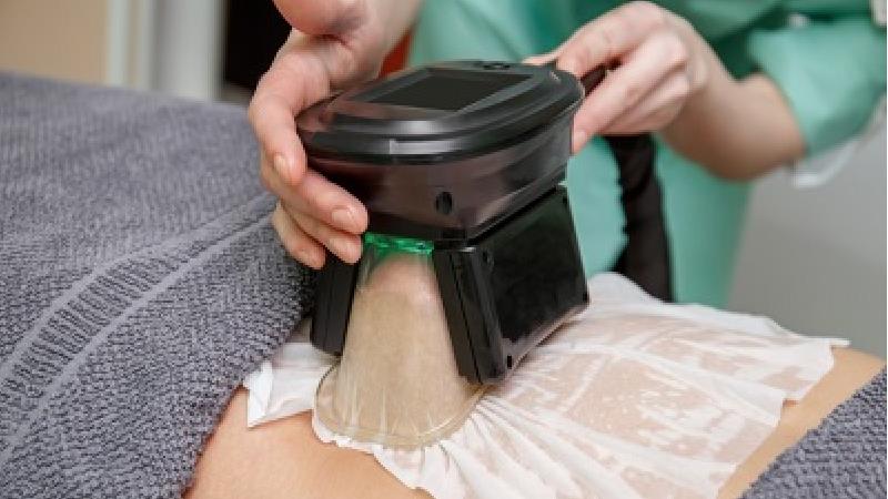 کرایولیپولیز چیست و چه مزایا و معایبی دارد