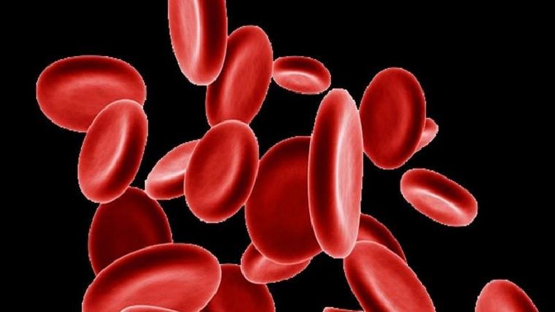 علل و علائم کم خونی در زنان + راه درمان