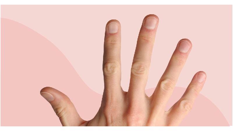 لکه های سفید روی ناخن نشانه چیست