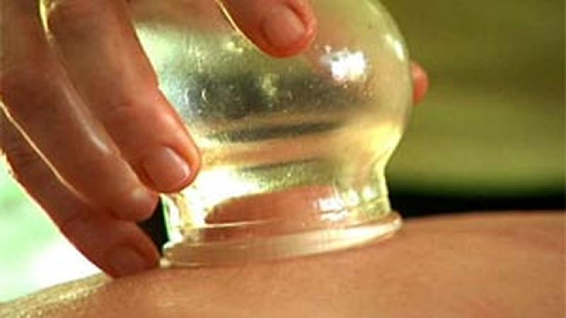 قبل و بعد از حجامت چه غذاها و میوه هایی را بخوریم