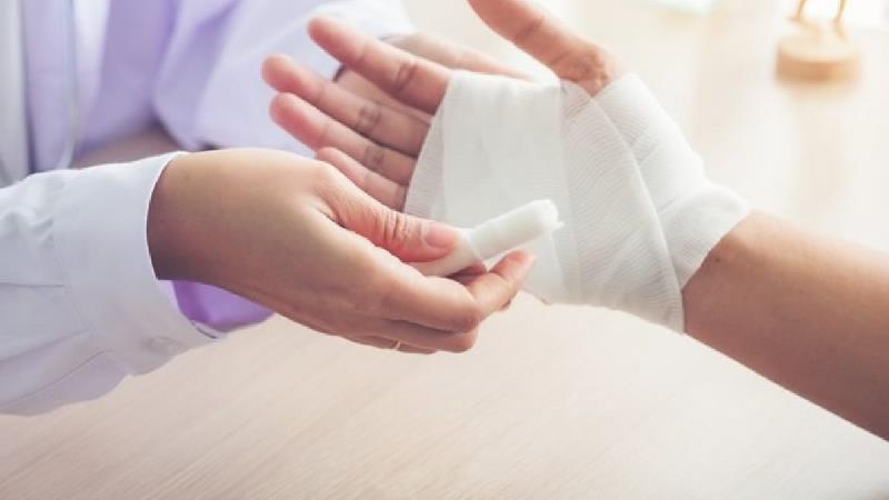 برای سوختگی دست چی خوب است؛ درمان خانگی و فوری