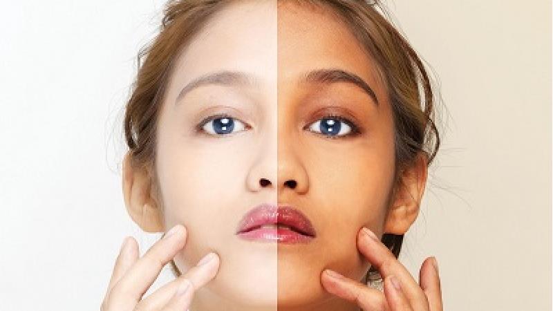 چکار کنیم پوست مان سفید شود