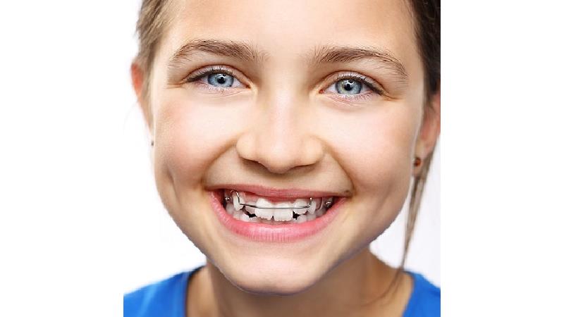 یک کلینیک ارتودنسی مناسب چه ویژگی هایی دارد؟