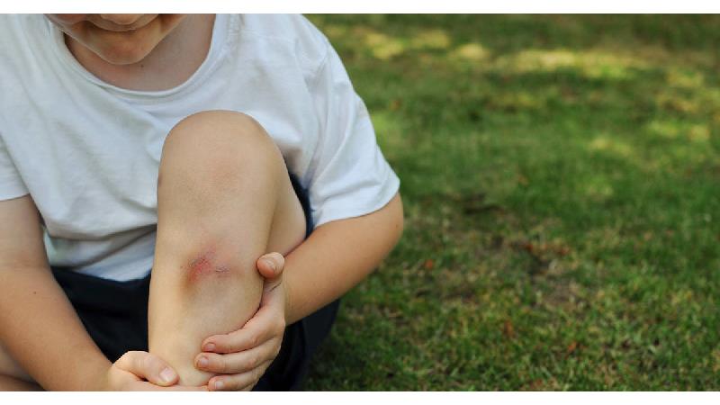 درمان های خانگی برای رفع کبودی بدن