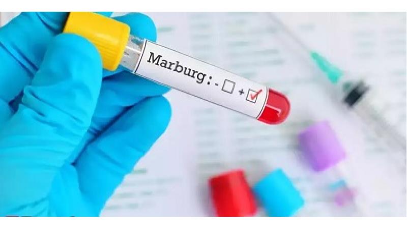 علائم، راه انتقال و روش درمان بیماری ماربورگ چیست