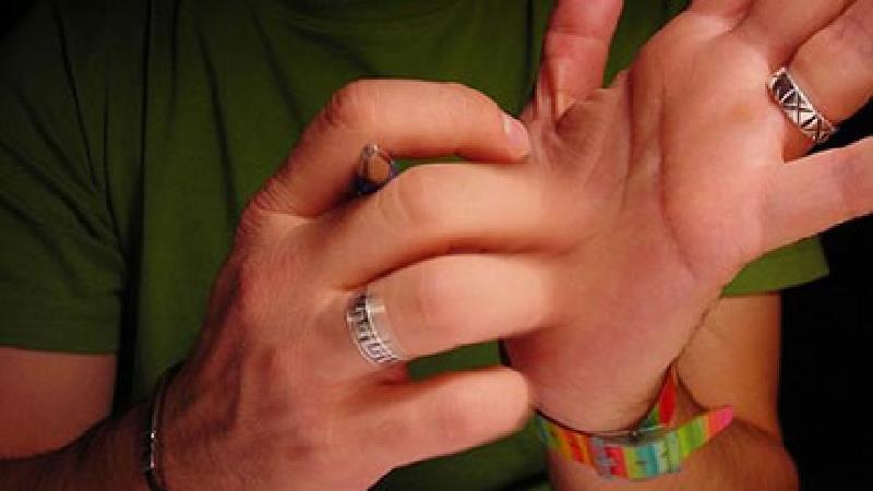 خارش کف دست نشانه چیست؛ علت ها و راه درمان