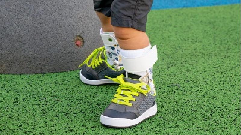 درمان پای پرانتزی در کودکان چگونه است