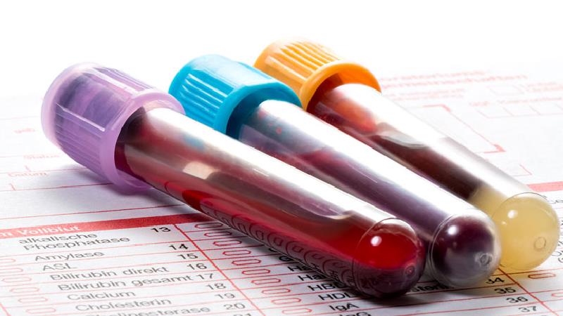 از کجا بفهمیم غلظت خون داریم