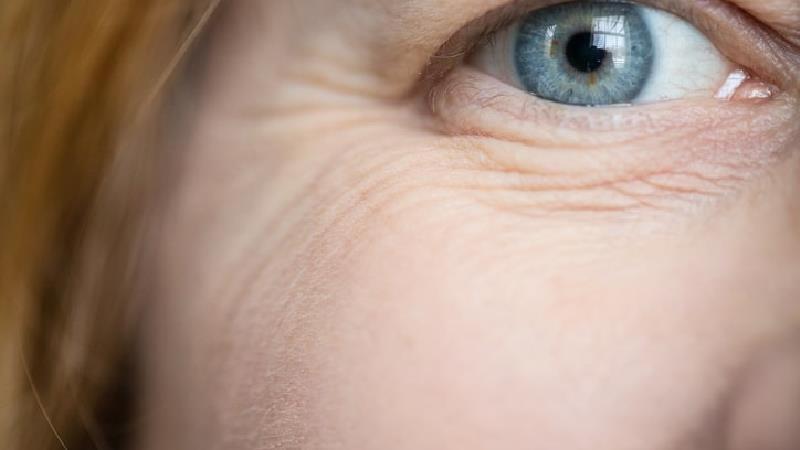 چکار کنیم دور چشم مان چروک نشود