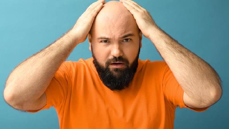 هزینه کاشت مو چطور محاسبه می‌شود ؟