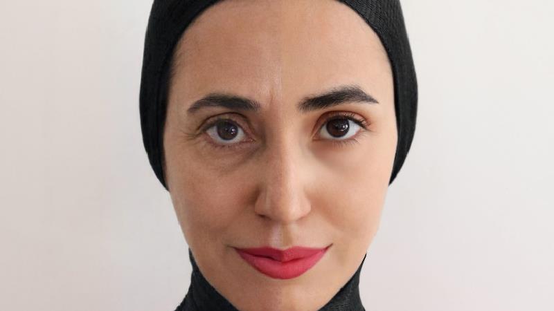 کلینیک زیبایی الیزه ارائه‌دهنده بهترین خدمات زیبایی با رعایت نکات بهداشتی