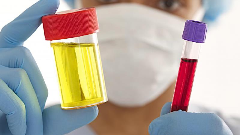 دلیل وجود خون در ادرار چیست؟